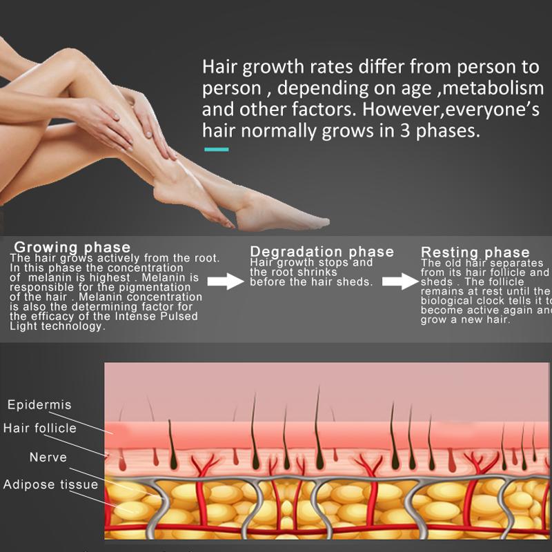 Safe and Painless: IPL hair removal has been proven to be gentle, high safety, no side effects, and painless